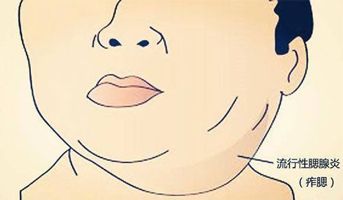 �����׵�֢״������ ��Щ���׵�������